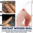thumbnail image 2 of Vendaje líquido de primeros auxilios a prueba de agua de 10ml yeso desinfectante para heridas cortadas pequeñas, 2 of 7