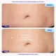 thumbnail image 5 of Crema Reafirmante para Abdomen goPure 125 mL, 5 of 8