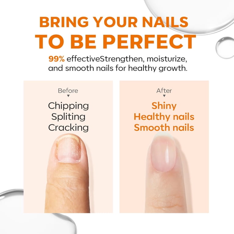 Nail Ridge Filler and Strengthener Treatment photo 5