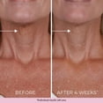 thumbnail image 4 of Crema reafirmante de cuello DEKLIDERM con retinol antienvejecimiento para mujeres, 4 of 8