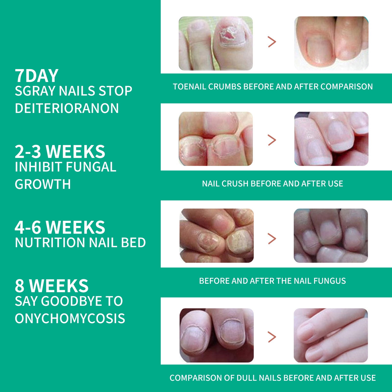 Alvantor Toenail Fungus Treatment for Damaged Nails, Moisturizing & Brightening Serum for Hands, Feet & Toenails, 0.34fl oz
