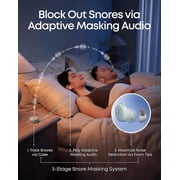 Soundcore Sleep A30 by Anker Sleep Earbuds, Smart Active Noise Cancelling Sleep Headphones, Adaptive Snore-Masking System, Ultra-Comfort for Side Sleepers, 45H Playtime
