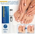 EELHOE Anti Fungus Blue Light Laser Pen