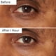 thumbnail image 4 of Sérum para ojos By Terry Hyaluronic Global con 8 ácidos hialurónicos, 4 of 9
