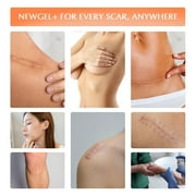 NewGel+ UV by MyNewGel Silicone Scar Gel + SPF30, Sun Protection & Scar Care, 15 g