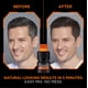 thumbnail image 2 of Tinte para el cabello L'Oréal Paris Men Expert Dark Brown 03, 1 kit, 2 of 8