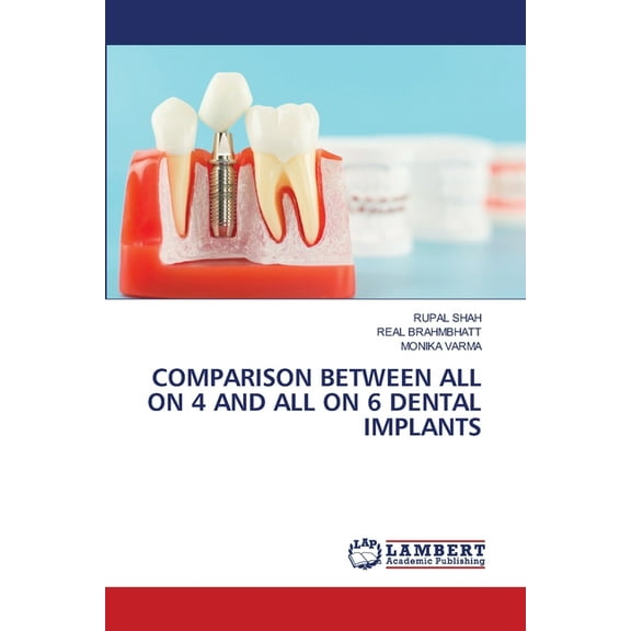 Comparison Between All on 4 and All on 6 Dental Implants, (Paperback)