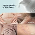 thumbnail image 4 of Silicone Scar Cream for Surgical and Bug Bite Scar Remover 0.73 Fl Oz - Scar Cream for New & Old Scars, C-Section and Burns - Vitamin E, Retinol and Allantoin, 4 of 7