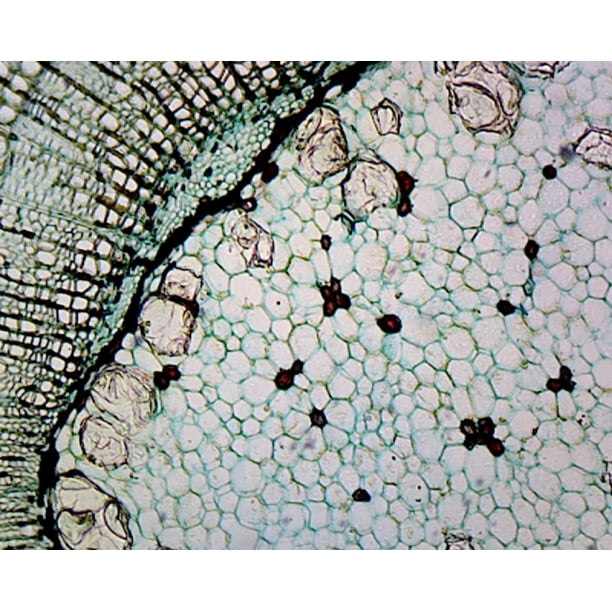 Cork Cells; Cross Section