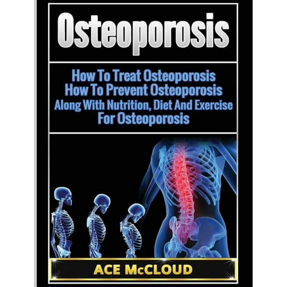 Reverse or Prevent Bone Loss from Osteop Osteoporosis: How To Treat Osteoporosis: How To Prevent Osteoporosis: Along With Nutrition, Diet And Exercise For Osteop, (Hardcover)