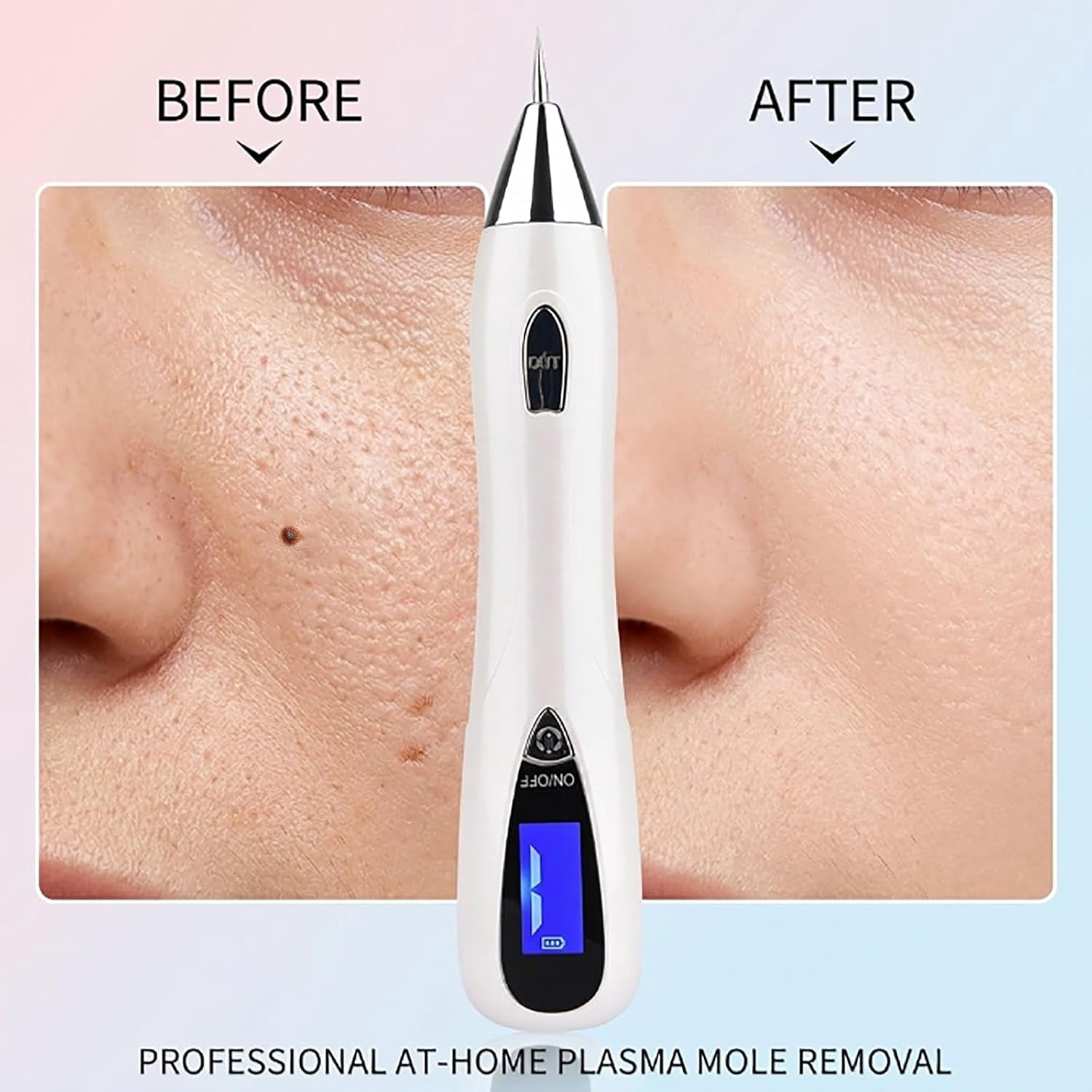 Pen, at-Home Beauty Tool, Designed for Gentle and Everyday Personal Care (Gold)