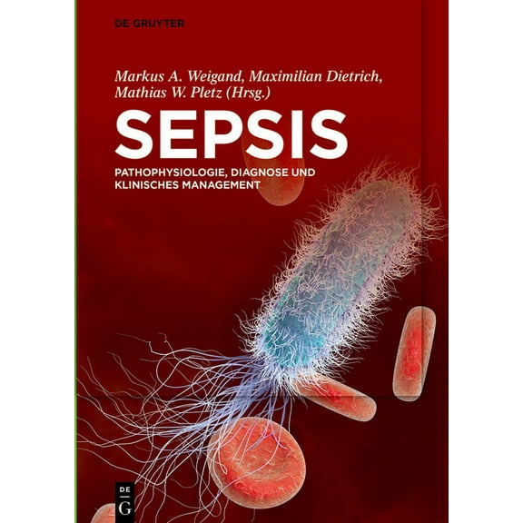 Sepsis, (Hardcover)