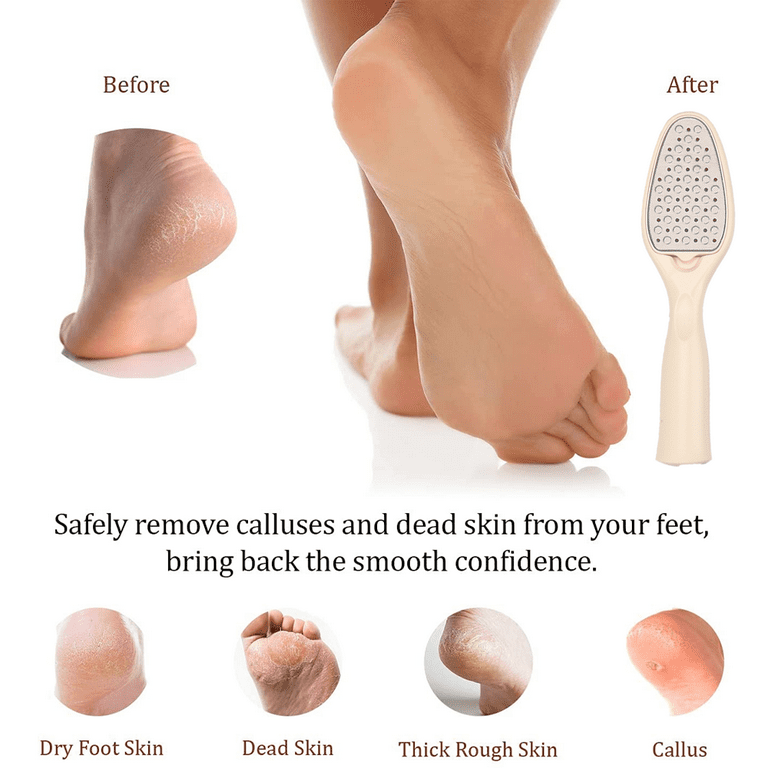 Best Foot care pedicure metal surface tool to remove hard skin. Can be Used on both wet and dry feet White