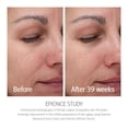 thumbnail image 3 of Crema Facial Renovadora Epionce Hidratante Antienvejecimiento Piel Seca, 3 of 9