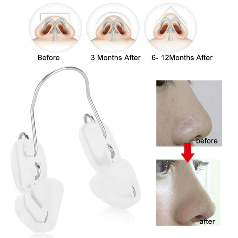 Nose Shaper For Wide Nose,Nose Shaper Nose Slap Nose Up Shaping Lifting  Straightening Clip Bridge Enhancer Shaper Transparent