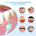 thumbnail image 1 of Raspador dental ultrasónico NQ Limpiador eléctrico de placa dental, 1 of 5