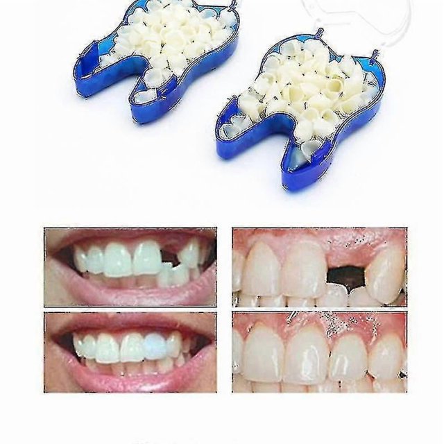 Temporary Denture Braces Occlude Upper Dentures Veneer Dentures Missing Teeth Broken Teeth Elq,khw