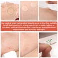 thumbnail image 3 of Zit Stickers Reveal A Cleaner Clearer Nose With Our Grade Blackhead Remover Strips A Must Have For Your Routine., 3 of 5