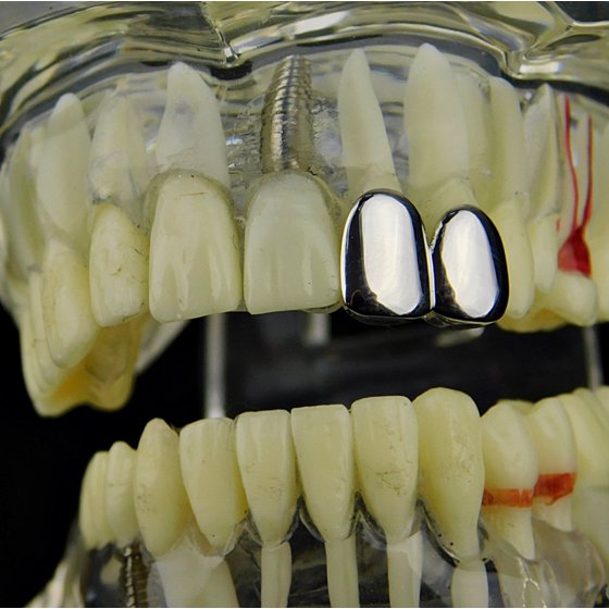 Best Grillz Double Two Tooth Grillz Top Left Side Silver Tone 2Tooth