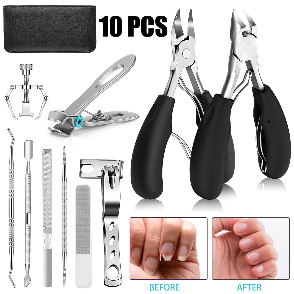 Austok 10 Pcs Nail Clippers Set Toenail Clippers Set Professional Stainless  Steel Fingernail Clippersfor Thick Nails Seniors Durable Toe Nail Cutter  for Adults and Seniors 