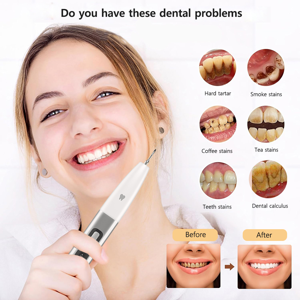 Ultrasonic Tooth Cleaner Electric Dental Calculus Remover Tartar Eliminator Dental Ultrasound Teeth Plaque Removal with UV Light