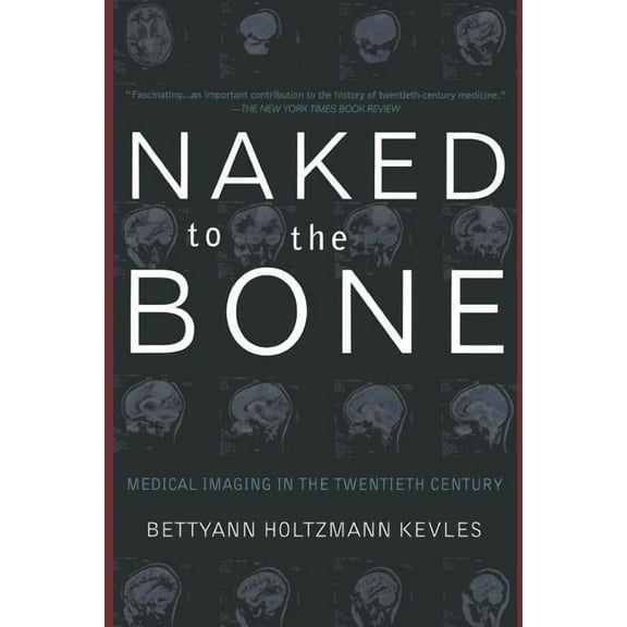 Naked to the Bone: Medical Imaging in the Twentieth Century, (Paperback)