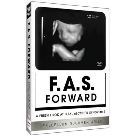 FAS Forward: A Fresh Look At Fetal Alcohol Syndrome