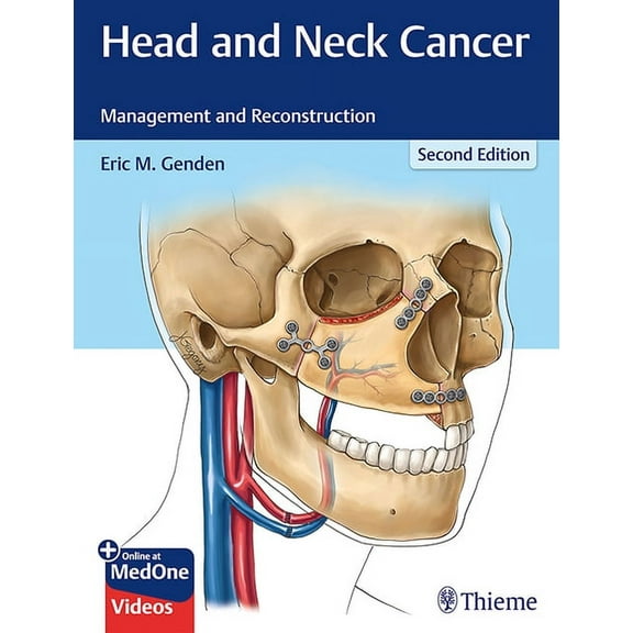 Head and Neck Cancer: Management and Reconstruction (Hardcover)