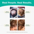 thumbnail image 5 of hair loss conditioner | all-natural dht blockers for thinning hair developed by dermatologists | experience healthier, fuller and thicker looking hair - shapiro md | 1-month hair conditioner supply, 5 of 5