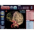 thumbnail image 3 of The Cerefy Atlas of Cerebral Vasculature, 3 of 4