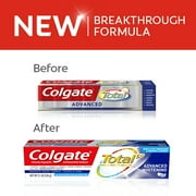Colgate Total Whitening Toothpaste, Advanced Whitening, 5.1 ounce