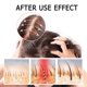 thumbnail image 2 of East Moon Dense Hair Essence Hair Care Anti-Fall Solid Hair Strength Thick urishing Hair Root Dense Hair Care, 2 of 5