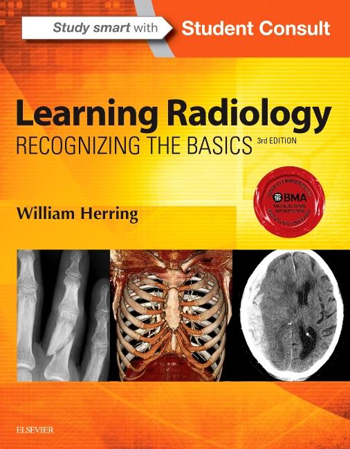 Learning Radiology Recognizing the Basics