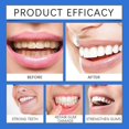 thumbnail image 2 of Gum Restore Liquid - Gum Therapy Serum, Gum Repair Drops for Receding Gums,Gum Restore Treatment, Teeth Freshening Mouthwash,Deeply Cleaning Teeth, 2 of 5