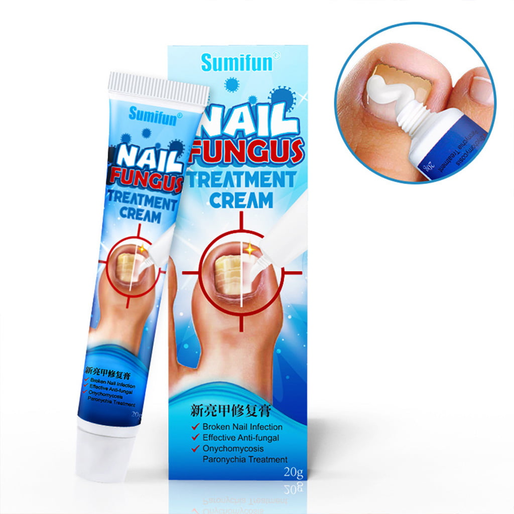Toenail Fungus Treatment,Anti-Fungal Nail Infection,Nail Fungus Treatment, Fungus Stop Cream,Toenails and Fingernails Whitening,Nail Fungus Removal  (20g) by LDREAMAM - Shop Online for Beauty in Germany