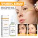thumbnail image 2 of Aceite de suero blanqueador para el rostro Essences Skin Care que ilumina el tono de la piel, reduce las manchas, alivia la piel opaca, loción para el cuidado de la piel 30 ml, 2 of 7