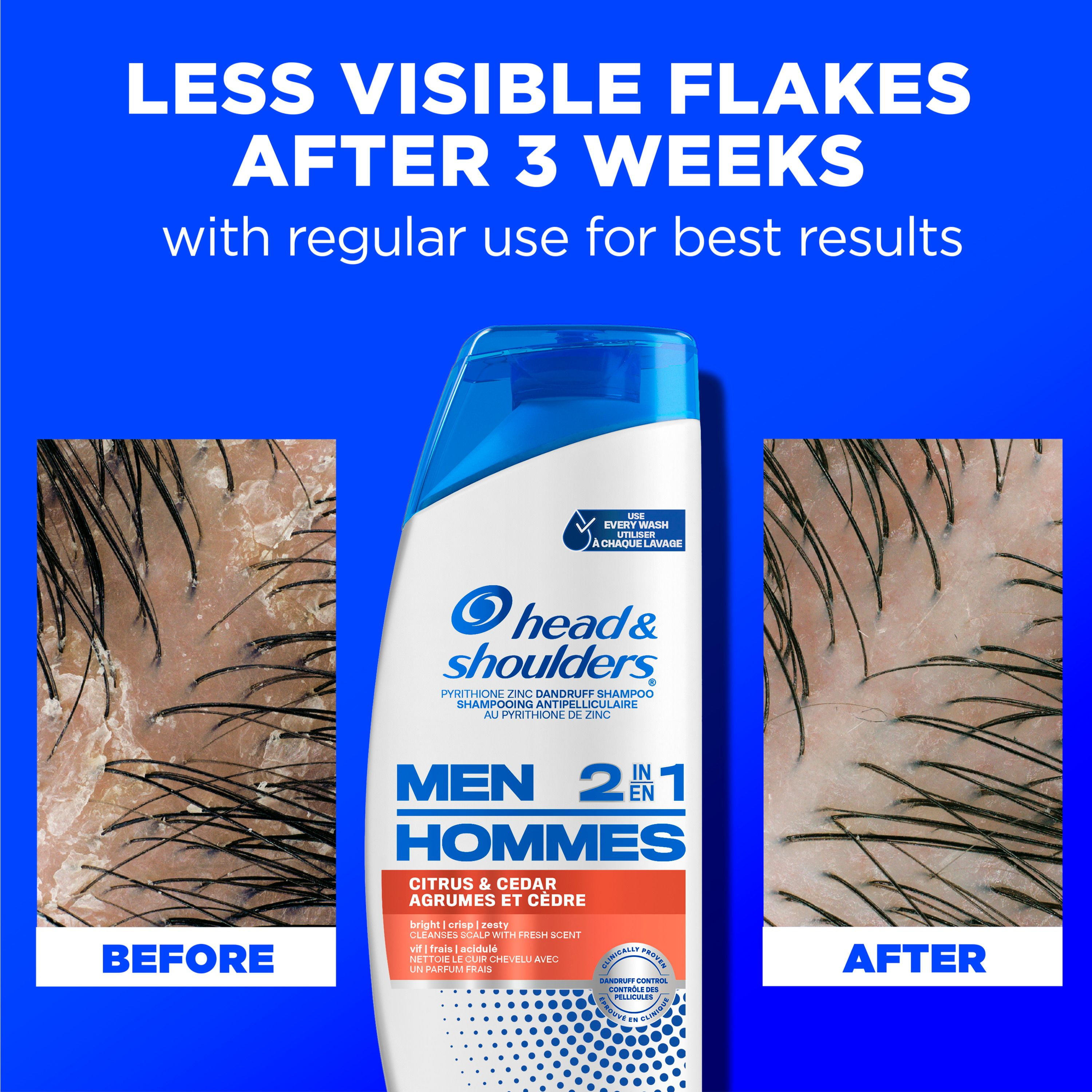 Shampooing et revitalisant antipelliculaire 2 en 1 Head and Shoulders pour hommes, traitement antipelliculaire, Agrumes et cèdre pour un usage quotidien, sans parabènes 370 ml