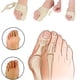 thumbnail image 2 of Ygjytge Corrección Ortopédica De Juanetes De Hueso Grande Hallux Valgus Corrector Brace (S) Ygjytge Para estrenar, 2 of 9