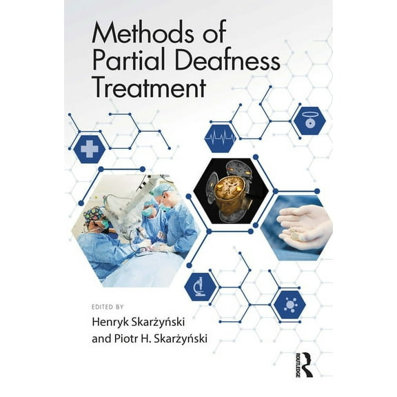 Methods of Partial Deafness Treatment, (Hardcover)