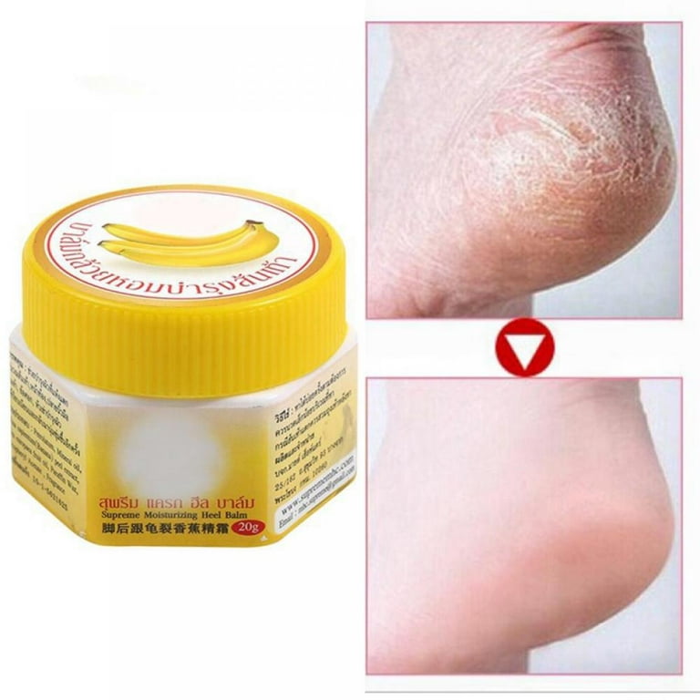 Banana Repair Foot Cream, Anti-cracking Dry Feet Balm, 30g Cracked Heel  Moisturizer, Foot Repair Moisturizing Remove Dead Skin, Foot Care Products  F