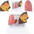 thumbnail image 4 of AURARMLET Lung Model For Anatomy Lung Comparison Model Multi 1 Pc 7.9x7.1x5.5in, 4 of 5