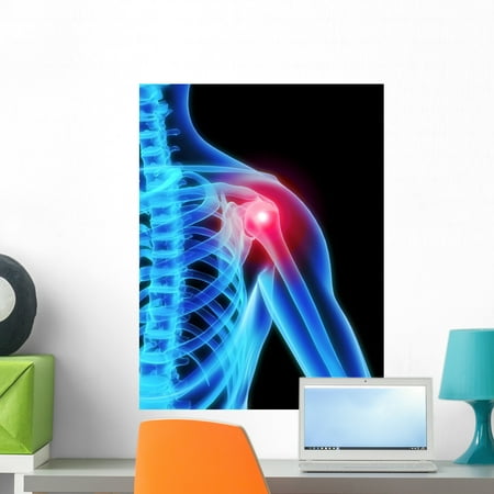 shoulder pain x-ray wall muralwallmonkeys peel and stick graphic