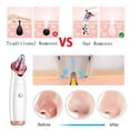 thumbnail image 3 of Seitruly Removedor de espinillas, succión eléctrica, recargable, ajustable, 3 modos, limpieza facial, exfoliación, suministros para el masajeadores, 3 of 6