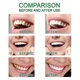 thumbnail image 5 of 1pcs Teeths Whitenings Pen Brightening Tool Portable For Travel/ Trip/ H, 5 of 5