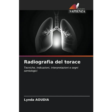 Radiografia del torace, (Paperback)