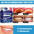 thumbnail image 5 of IBeaLee Dental Spot Cleansing Solution for Removing Smoke Stains, Dental Spot Cleaning, Toothpaste for Removing Bacterial Stains, Bad breath, and Dental Stones, 5 of 5