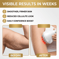thumbnail image 2 of White Cordless Body Sculpting Massager, Handheld Heating Vibration Massage Tool with 35 Speeds, Anti-Cellulite Skin Smoothing & Toning Device, 2 of 5