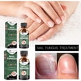 thumbnail image 3 of Nail Fungal Treatment Toenail Treatment Extra Strong Nail Repair Fingernail Fix & Renew Damaged Discolored Nails, 3 of 5