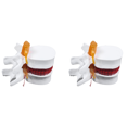 thumbnail image 1 of 2X Human Anatomy Skeleton Spine Lumbar Disc Herniation Teaching Model Brain Traumatic School Supplies Instrume, 1 of 9