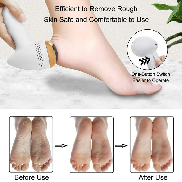 Foot File With Egg Ped Shape Foot Scrubber For Dead Hard Skin And